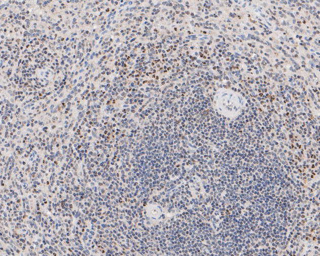 HMGB2 Antibody in Immunohistochemistry (Paraffin) (IHC (P))