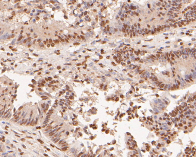 H3K4me1 Antibody in Immunohistochemistry (Paraffin) (IHC (P))