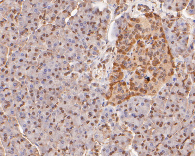 H3K4me1 Antibody in Immunohistochemistry (Paraffin) (IHC (P))