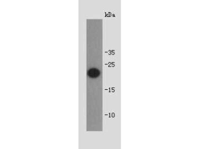 Shiga toxin 1B Antibody in Western Blot (WB)