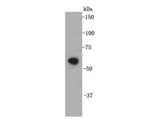 FGFR2 Antibody in Western Blot (WB)