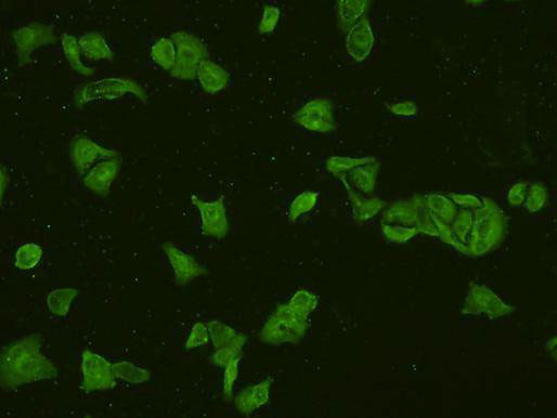 PI3K p85 alpha Antibody in Immunocytochemistry (ICC/IF)