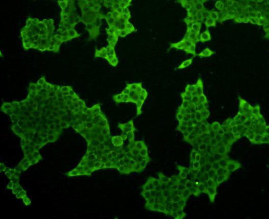 GPX1 Antibody in Immunocytochemistry (ICC/IF)