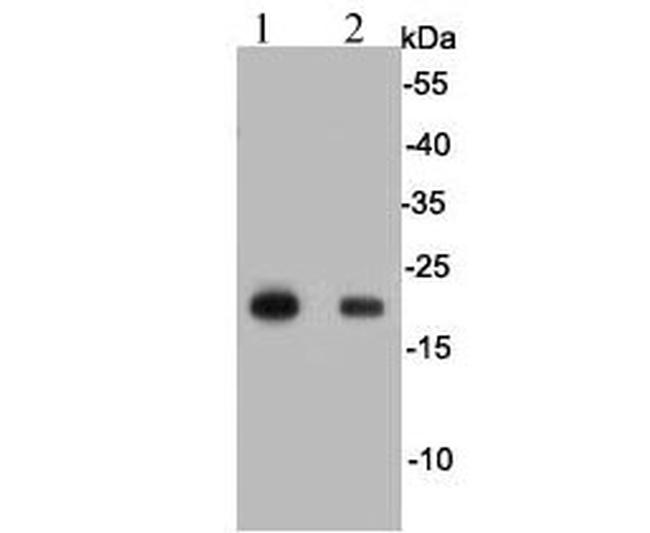 GPX1 Antibody in Western Blot (WB)