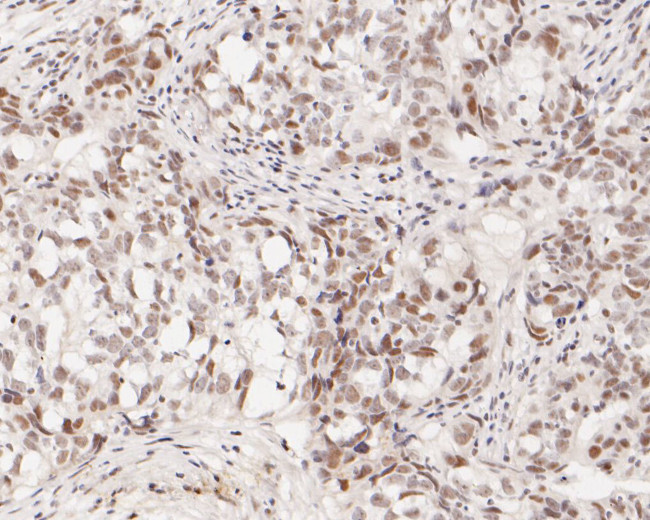 ASH2L Antibody in Immunohistochemistry (Paraffin) (IHC (P))