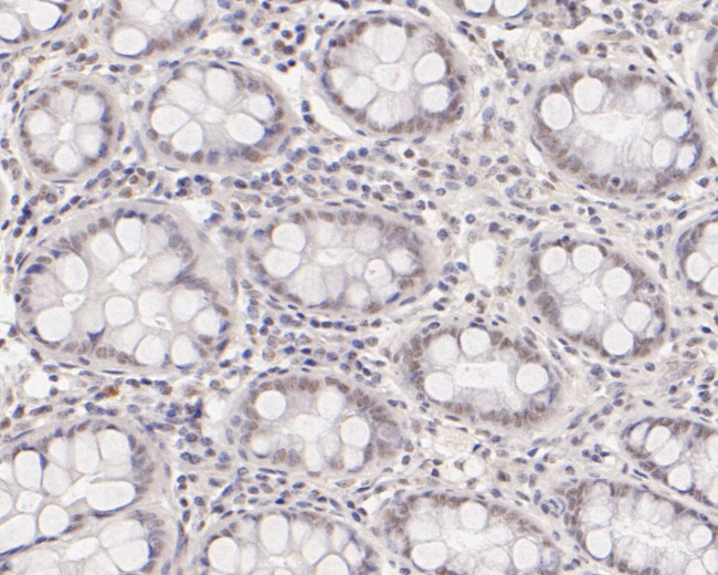 ASH2L Antibody in Immunohistochemistry (Paraffin) (IHC (P))