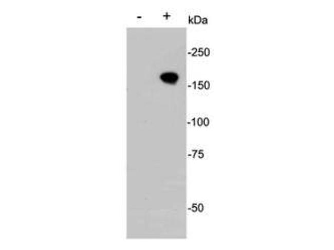 Cas9 Antibody in Western Blot (WB)