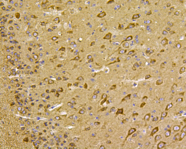 HSPA9 Antibody in Immunohistochemistry (Paraffin) (IHC (P))