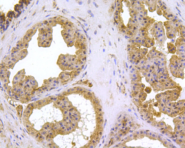 HSPA9 Antibody in Immunohistochemistry (Paraffin) (IHC (P))