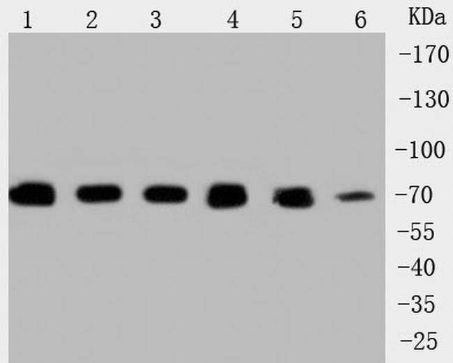 HSPA9 Antibody in Western Blot (WB)