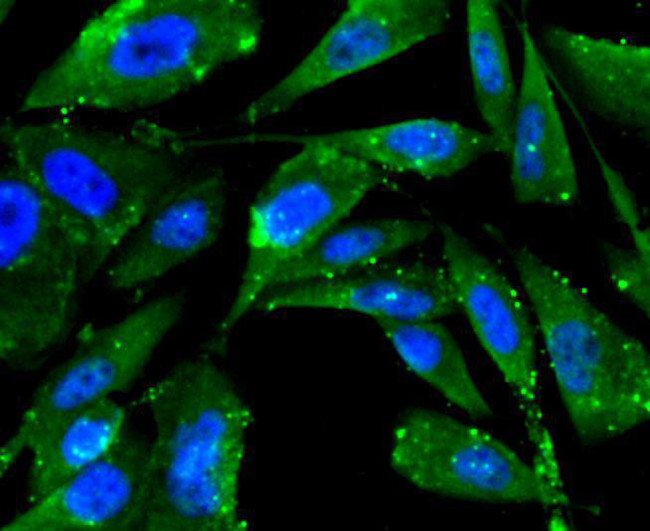 FPR2 Antibody in Immunocytochemistry (ICC/IF)