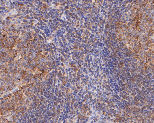 PLCG2 Antibody in Immunohistochemistry (Paraffin) (IHC (P))