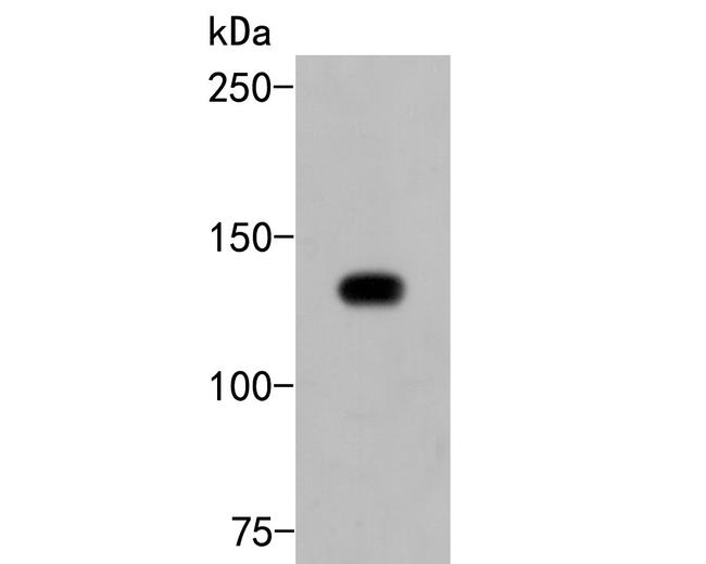 PLCG2 Antibody in Western Blot (WB)