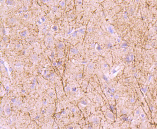 NF-H Antibody in Immunohistochemistry (Paraffin) (IHC (P))