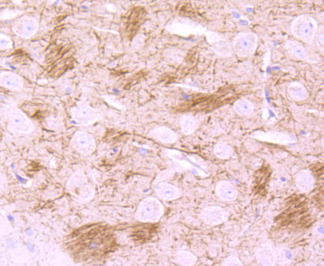 NF-H Antibody in Immunohistochemistry (Paraffin) (IHC (P))