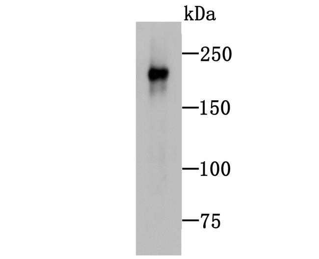 NF-H Antibody in Western Blot (WB)