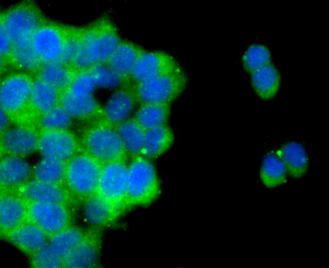 ALDH1A1 Antibody in Immunocytochemistry (ICC/IF)