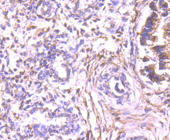 ALDH1A1 Antibody in Immunohistochemistry (Paraffin) (IHC (P))