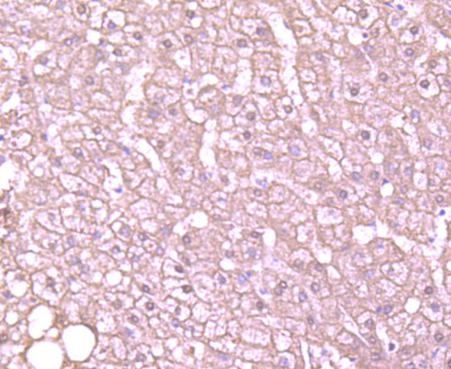 ALDH1A1 Antibody in Immunohistochemistry (Paraffin) (IHC (P))