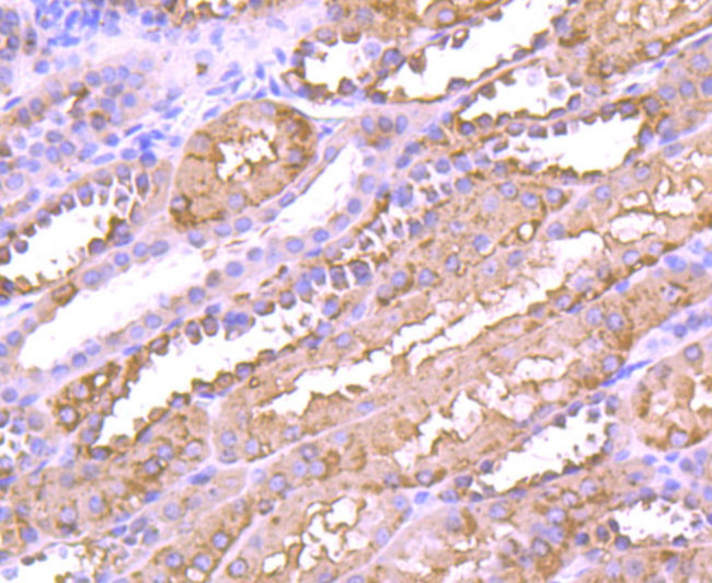 ALDH1A1 Antibody in Immunohistochemistry (Paraffin) (IHC (P))