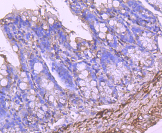 ALDH1A1 Antibody in Immunohistochemistry (Paraffin) (IHC (P))