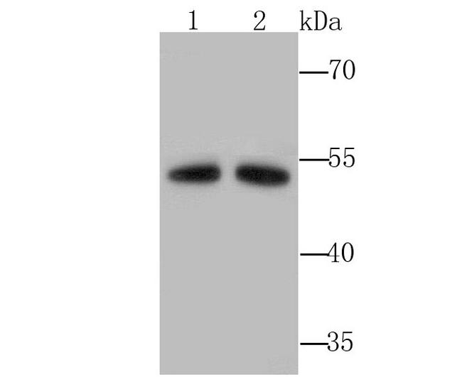 ALDH1A1 Antibody in Western Blot (WB)