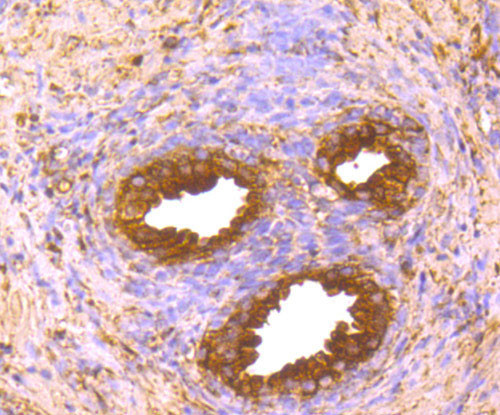 FASN Antibody in Immunohistochemistry (Paraffin) (IHC (P))