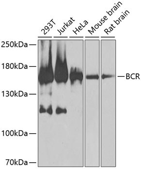 Bcr Antibody in Western Blot (WB)