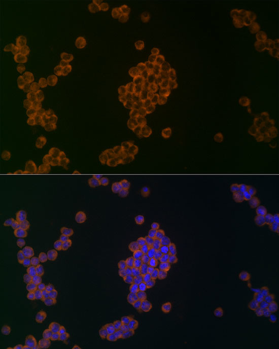 ATG5 Antibody in Immunocytochemistry (ICC/IF)