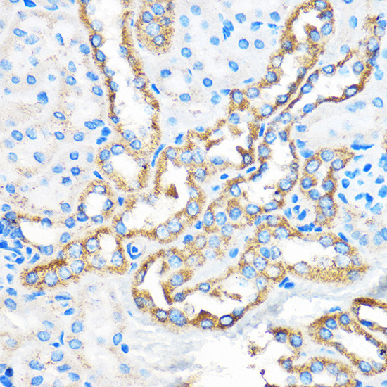 ATG5 Antibody in Immunohistochemistry (Paraffin) (IHC (P))