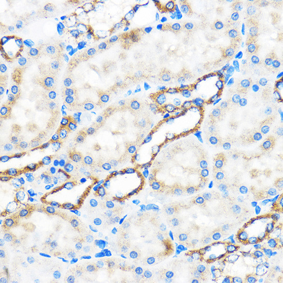 ATG5 Antibody in Immunohistochemistry (Paraffin) (IHC (P))