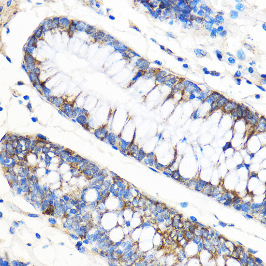 ATG5 Antibody in Immunohistochemistry (Paraffin) (IHC (P))