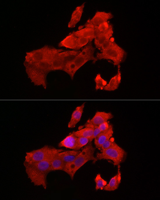 BAX Antibody in Immunocytochemistry (ICC/IF)