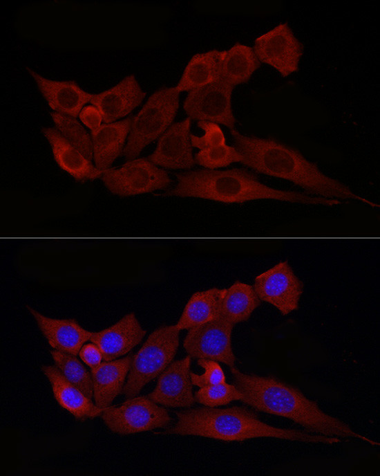 BAX Antibody in Immunocytochemistry (ICC/IF)