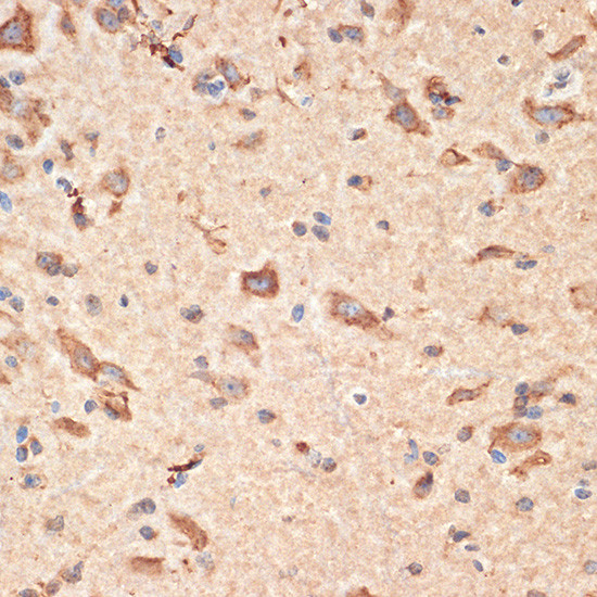 BAX Antibody in Immunohistochemistry (Paraffin) (IHC (P))