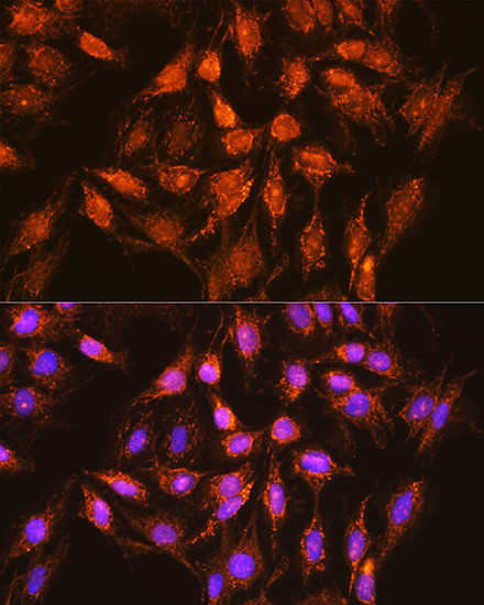 BCL-XL Antibody in Immunocytochemistry (ICC/IF)