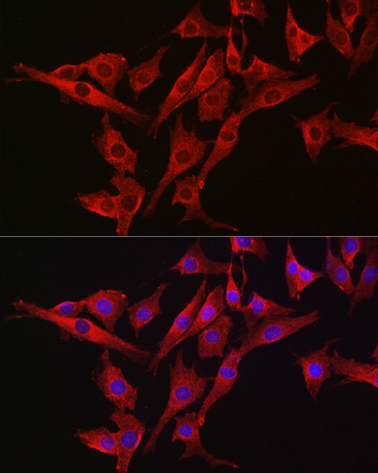 Caspase 3 Antibody in Immunocytochemistry (ICC/IF)