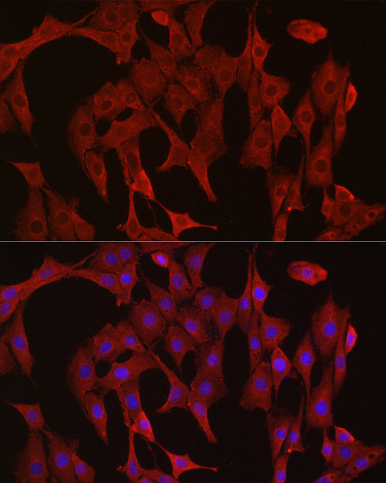 Caspase 3 Antibody in Immunocytochemistry (ICC/IF)