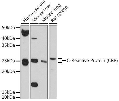 CRP Antibody in Western Blot (WB)