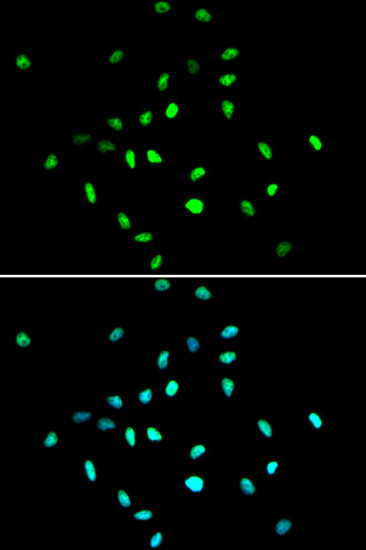 HDAC1 Antibody in Immunocytochemistry (ICC/IF)