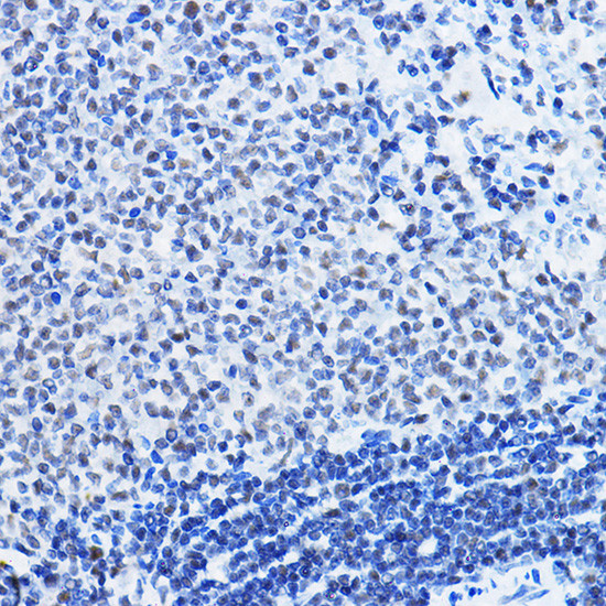 HDAC1 Antibody in Immunohistochemistry (Paraffin) (IHC (P))