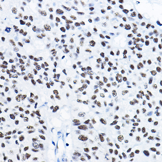 HDAC1 Antibody in Immunohistochemistry (Paraffin) (IHC (P))