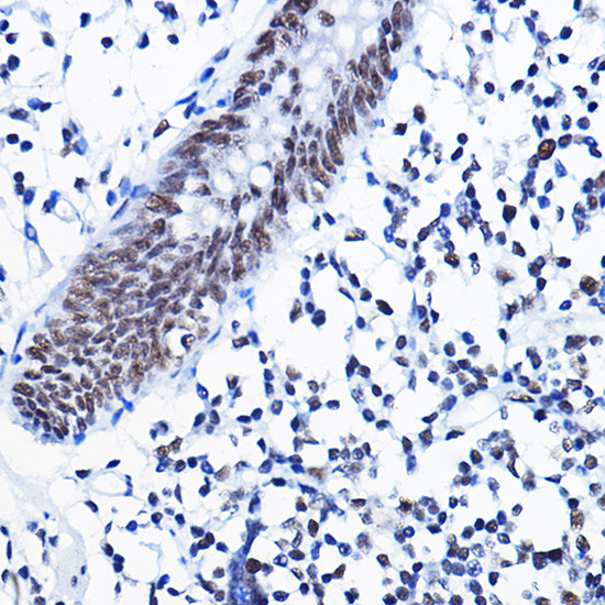 HDAC1 Antibody in Immunohistochemistry (Paraffin) (IHC (P))