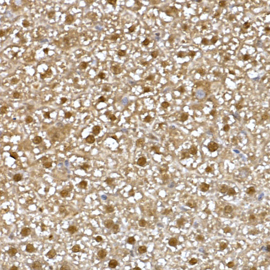 NAMPT Antibody in Immunohistochemistry (Paraffin) (IHC (P))