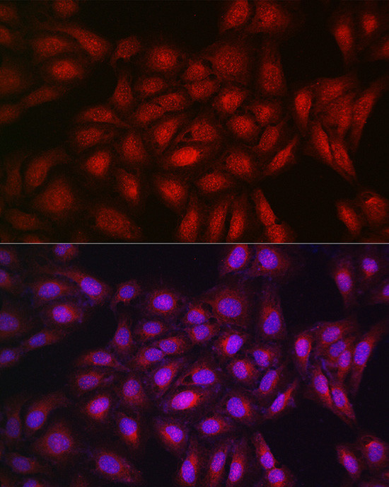 PPAR gamma Antibody in Immunocytochemistry (ICC/IF)