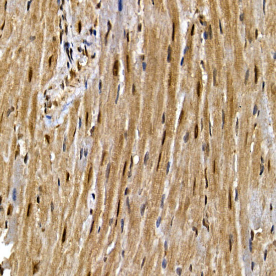 PPAR gamma Antibody in Immunohistochemistry (Paraffin) (IHC (P))