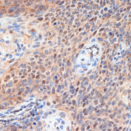 CDK2 Antibody in Immunohistochemistry (Paraffin) (IHC (P))