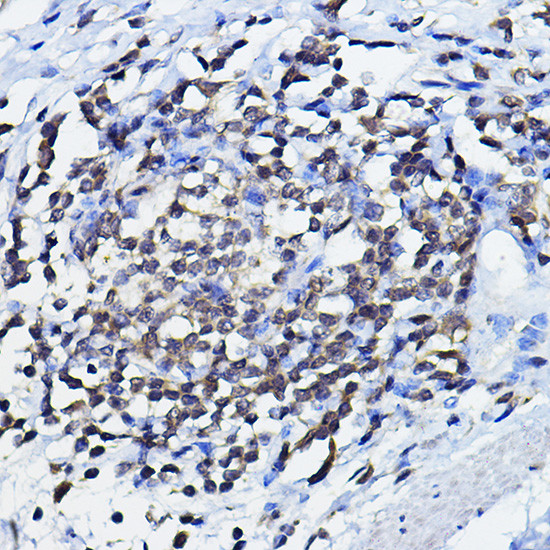 p73 Antibody in Immunohistochemistry (Paraffin) (IHC (P))