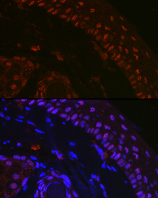 p73 Antibody in Immunohistochemistry (Paraffin) (IHC (P))