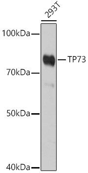 p73 Antibody in Western Blot (WB)